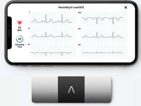 Kardia by AliveCor - KardiaMobile 6L Six-Lead Personal ECG Monitor - Detects AFib Online